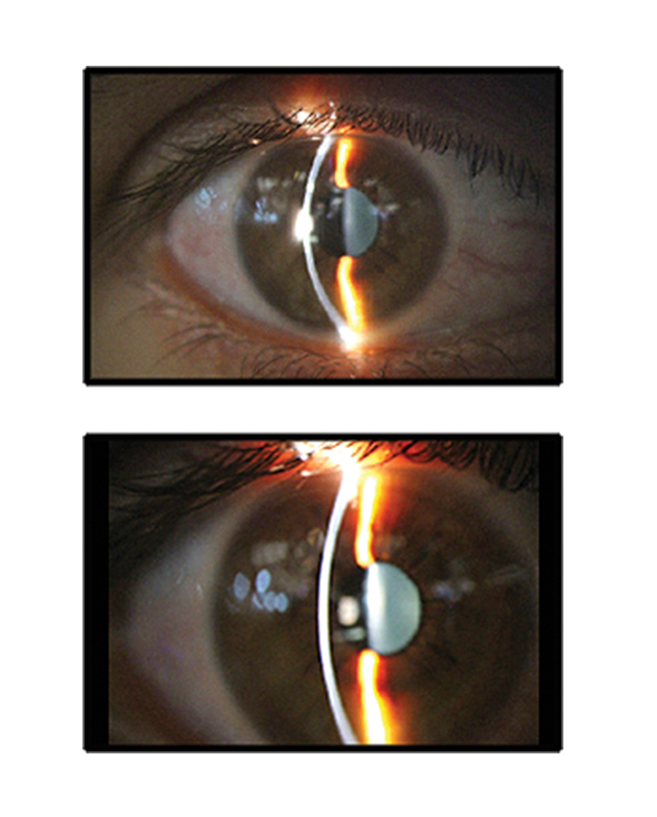 Slit Lamp Claricon Max HD