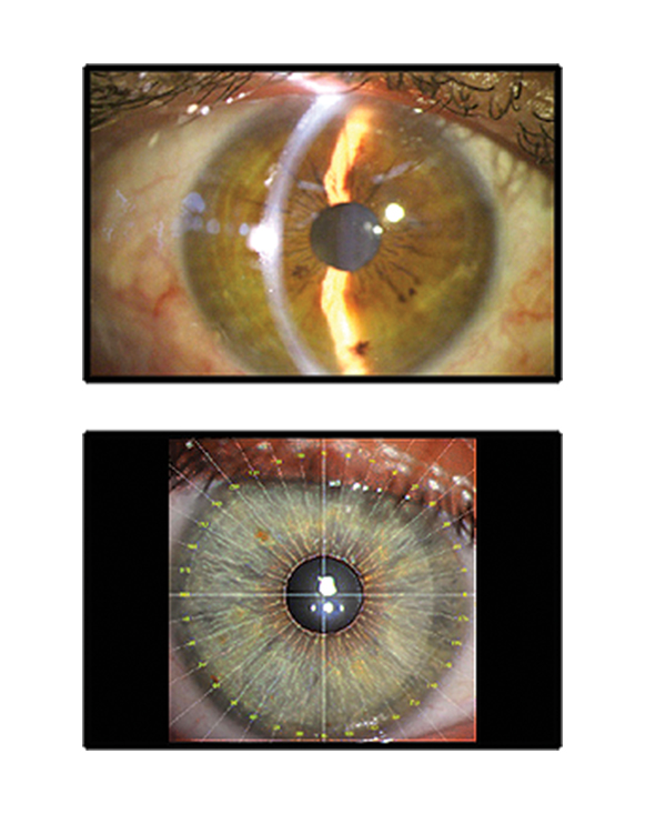 Claricon Max HD Slit Lamp