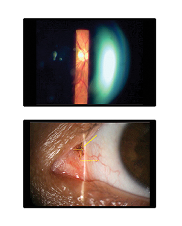 Slit Lamp Claricon Max HD